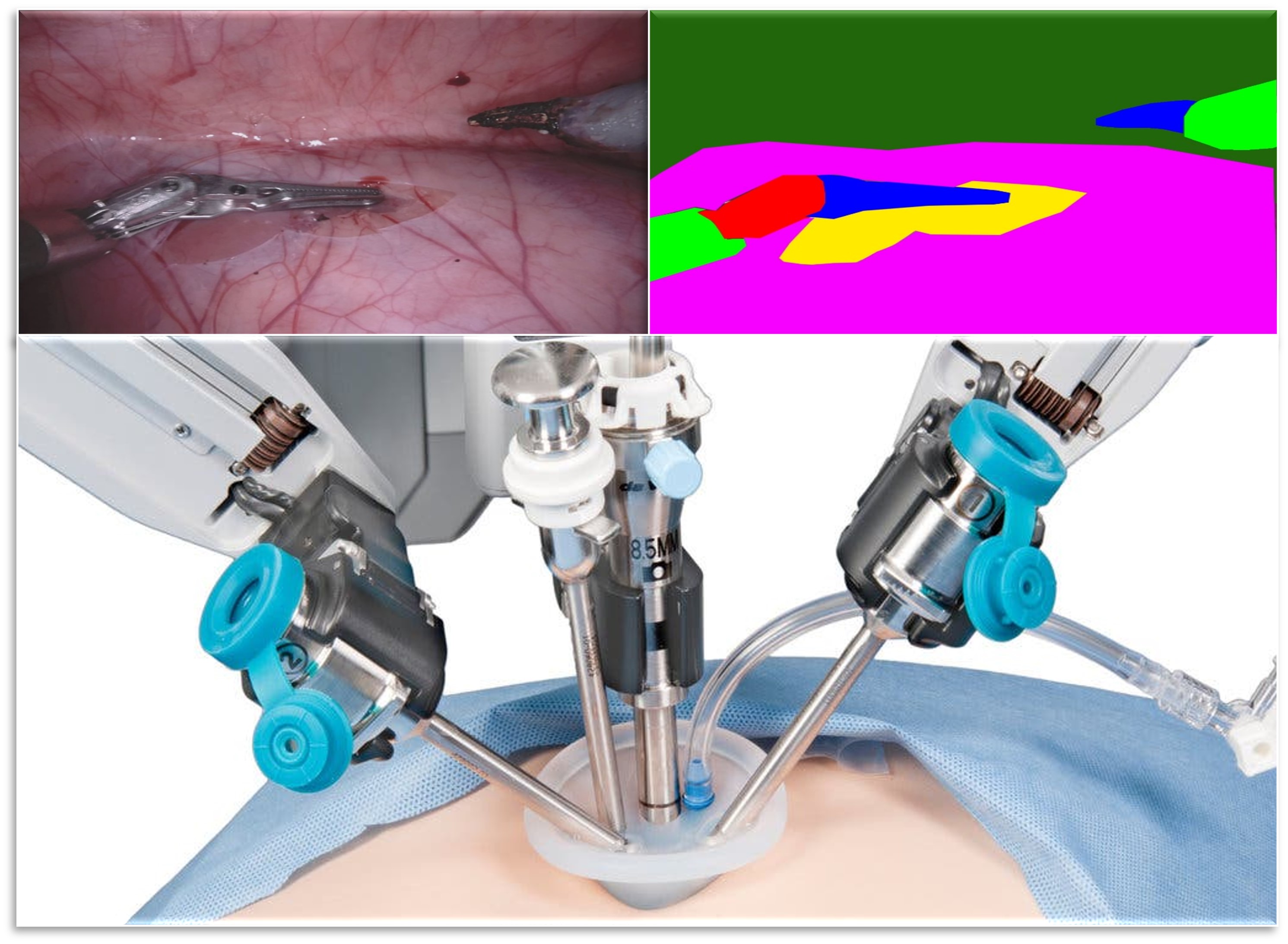 Kidney Robotic Surgery Segmentations